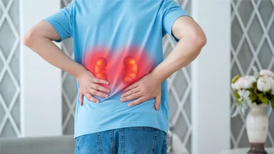 Kidney Stone Surgeries