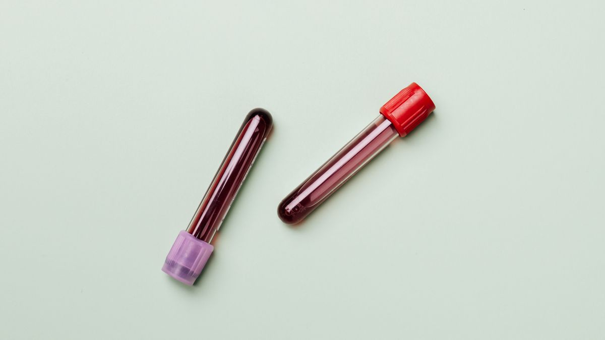 Blood sample tubes used for the daily platelet count and haematocrit monitoring that guides dengue treatment