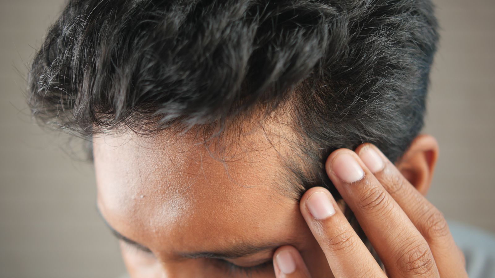 Man touching his temple to check his receding hairline