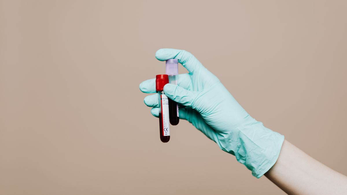 Laboratory technician holding sample tubes for the urine and blood tests that distinguish kidney stones from kidney infection